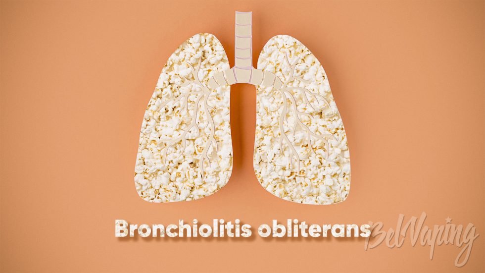 Bronchiolitis obliterans - попкорновые легкие